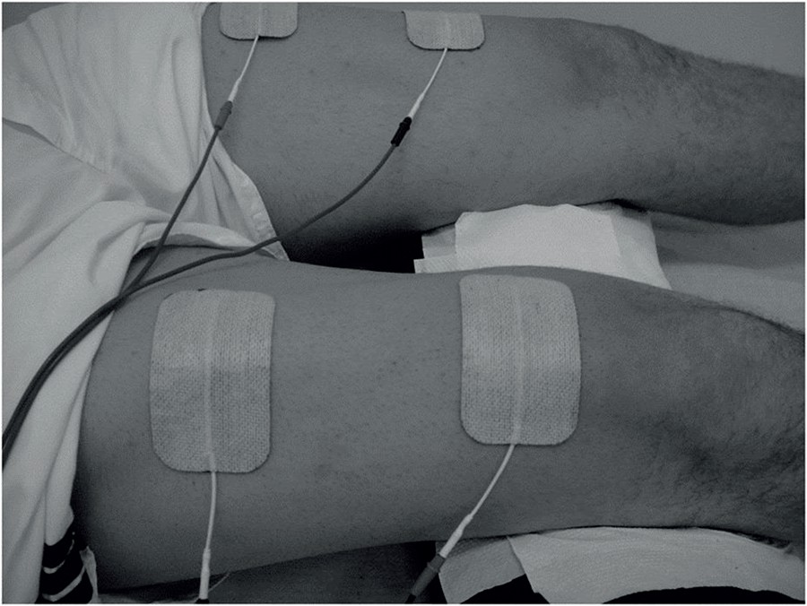 A Simpler and Shorter Neuromuscular Electrical Stimulation Protocol